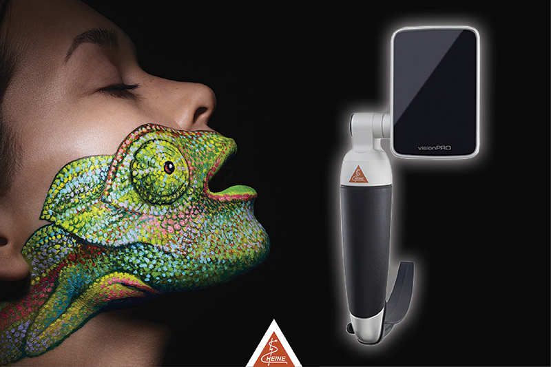 The History of Laryngoscopes: From Mirrors To Video Cameras